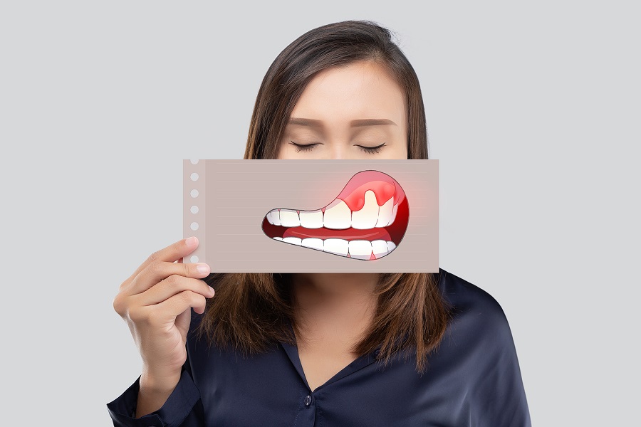 Do you Have Gum Recession?